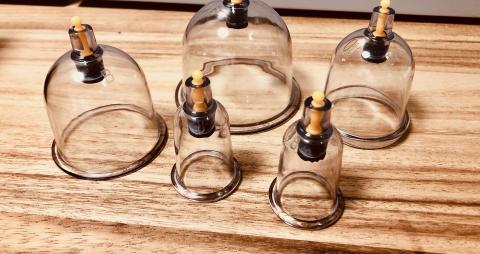 Cupping Massage in Pittsburgh